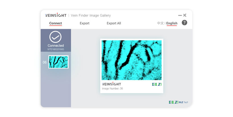 VeinSight vein finder/vein illuminator/vein light